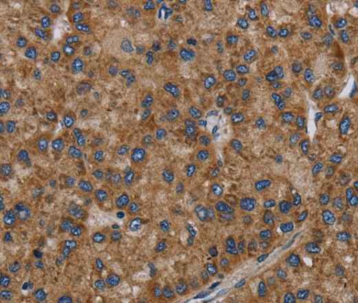 Anti-Human NECTIN2 Antibody