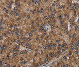 Anti-Human NECTIN2 Antibody - ABMIUM