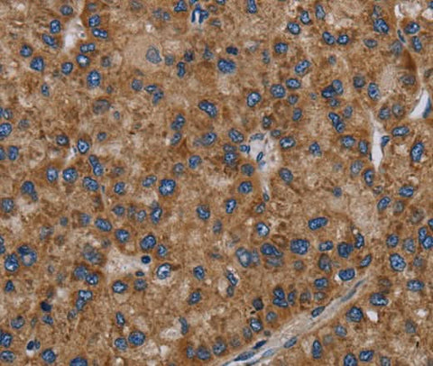 Anti-Human NECTIN2 Antibody - ABMIUM