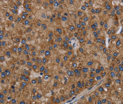 Anti-Human NECTIN2 Antibody - ABMIUM