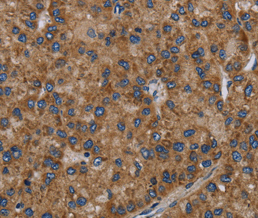 Anti-Human NECTIN2 Antibody - ABMIUM