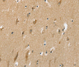 Anti-Human/Rat SLC6A7 Antibody - ABMIUM
