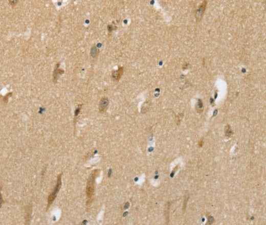 Anti-Human/Rat SLC6A7 Antibody