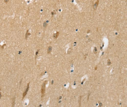 Anti-Human/Rat SLC6A7 Antibody - ABMIUM