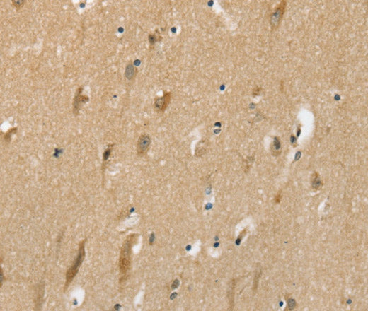 Anti-Human/Rat SLC6A7 Antibody - ABMIUM