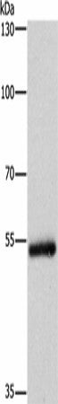 Anti-Human CYP2B6 Antibody - ABMIUM