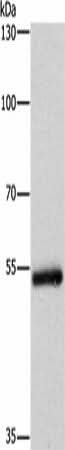 Anti-Human CYP2B6 Antibody - ABMIUM