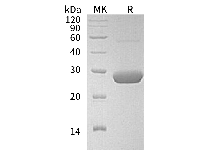 Recombinant Human LYPLA2 Protein (His Tag) - ABMIUM