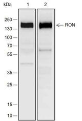 Anti-Human RON Antibody [A721]