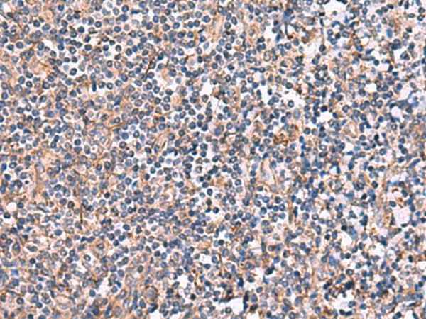 Anti-Human/Mouse INPP5B Antibody