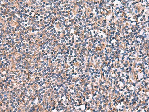 Immunohistochemistry of paraffin-embedded Human tonsil tissue using INPP5B Polyclonal Antibody at dilution of 1:40(×200)