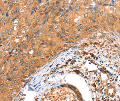 Anti-Human ACOX3 Antibody - ABMIUM