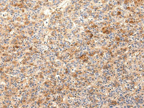 Anti-Human ZNF365 Antibody - ABMIUM
