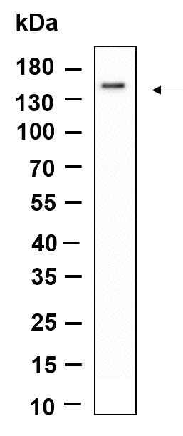 Anti-Human/Mouse/Rat SMC3 Antibody [B942] - ABMIUM