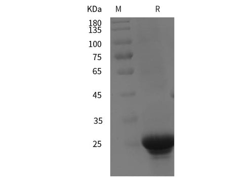 SDS-PAGE analysis of Human RAB6A proteins, 2 μg/lane of Recombinant Human RAB6A proteins was resolved with SDS-PAGE under reducing conditions, showing bands at 25 kDa.