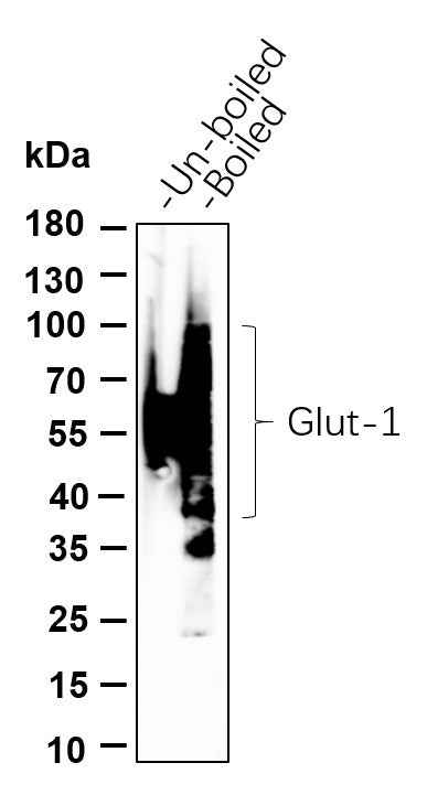 Anti-Human/Mouse/Rat Glut1 Antibody [B880] - ABMIUM
