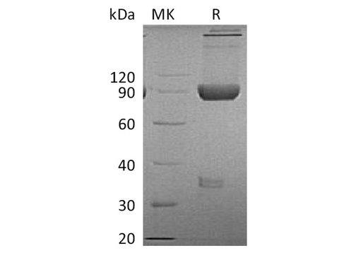 Recombinant Cynomolgus LAG-3/CD223 Protein (Fc Tag) - ABMIUM