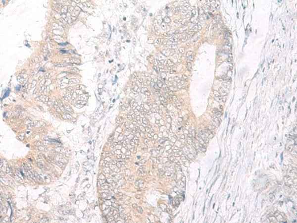 Anti-Human IL17A Antibody
