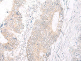 Anti-Human IL17A Antibody - ABMIUM