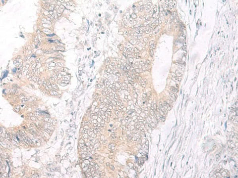 Anti-Human IL17A Antibody - ABMIUM