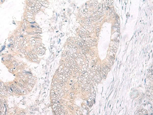 Anti-Human IL17A Antibody - ABMIUM