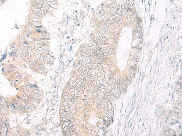 Anti-Human IL17A Antibody - ABMIUM