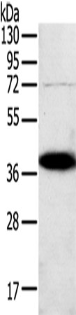 Anti-Human/Mouse/Rat SPARC Antibody - ABMIUM