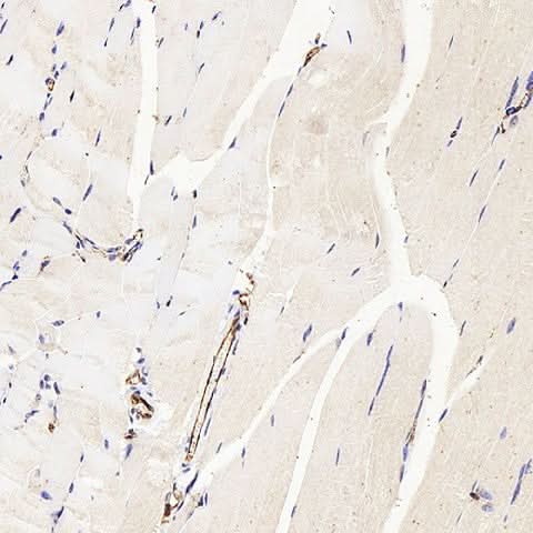 Immunohistochemistry analysis of paraffin-embedded mouse skeletal muscle using CD31 Polyclonal Antibody at dilution of 1:300.