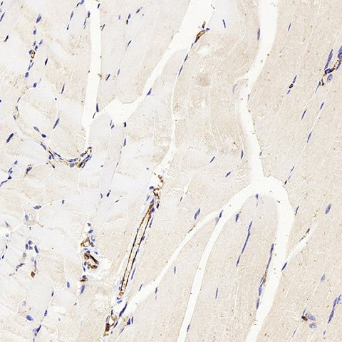 Immunohistochemistry analysis of paraffin-embedded mouse skeletal muscle using CD31 Polyclonal Antibody at dilution of 1:300.