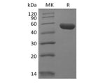 Recombinant Human Leukocyte-associated Immunoglobulin-like Receptor 2/ LAIR2/CD306 (C-Fc) - ABMIUM
