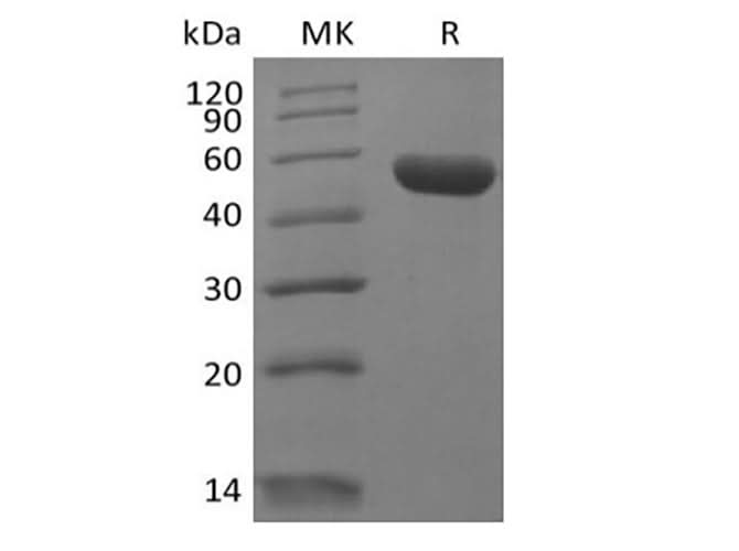 Recombinant Human Leukocyte-associated Immunoglobulin-like Receptor 2/ LAIR2/CD306 (C-Fc) - ABMIUM
