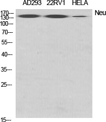 Western Blot analysis of various cells using ERBB2 Polyclonal Antibody at dilution of 1:2000.