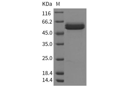 Recombinant Human beta Amylase/AMY2 Protein (His Tag) - ABMIUM