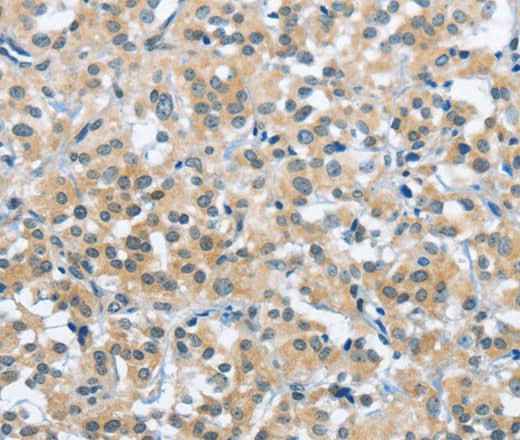 Anti-Human/Mouse/Rat TRDMT1 Antibody