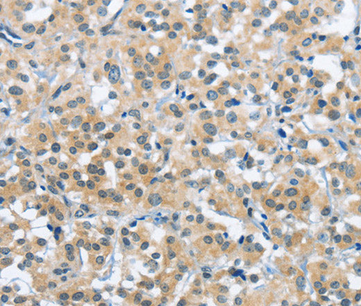 Anti-Human/Mouse/Rat TRDMT1 Antibody - ABMIUM