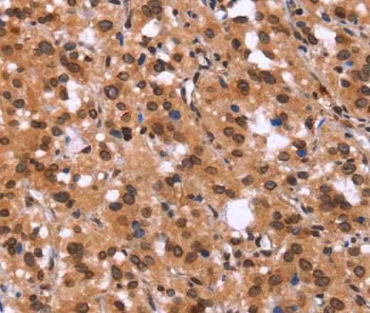 Anti-Human/Mouse GPR124 Antibody