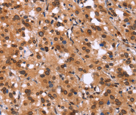 Anti-Human/Mouse GPR124 Antibody - ABMIUM