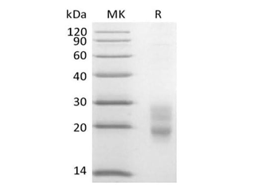 Recombinant Mouse CD7/Leu-9 (C-6His) - ABMIUM