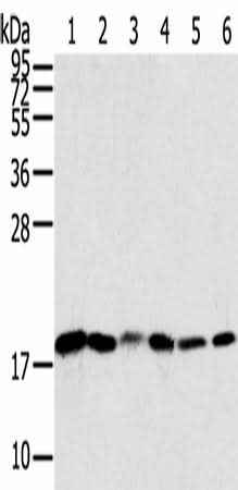 Anti-Human/Mouse/Rat SNX3 Antibody