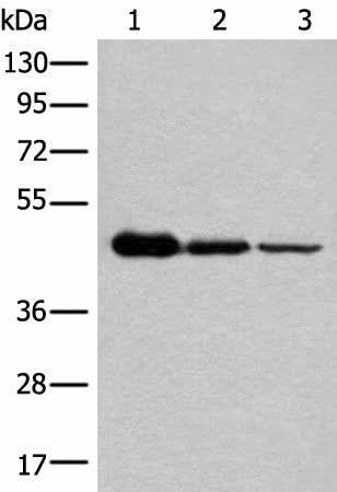 Western blot analysis of HEPG2 Hela and A549 cell lysates using NADK2 Polyclonal Antibody at dilution of 1:600