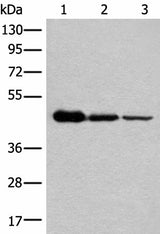 Western blot analysis of HEPG2 Hela and A549 cell lysates using NADK2 Polyclonal Antibody at dilution of 1:600