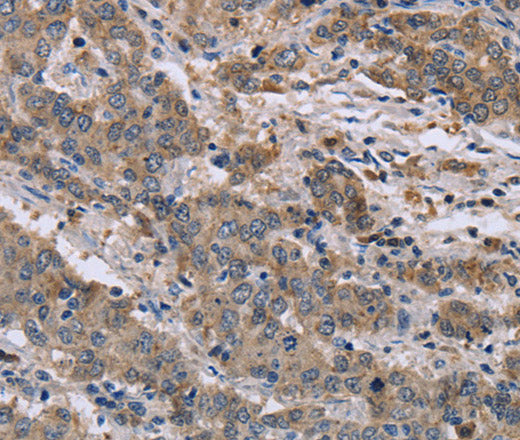 Anti-Human/Mouse/Rat GSN Antibody - ABMIUM