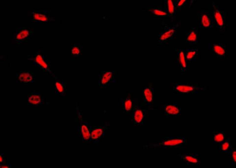 Anti-Human HSF1 Antibody [A1273] - ABMIUM