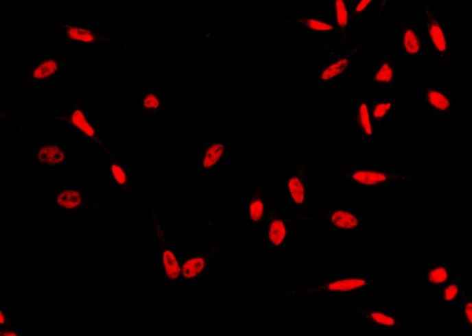 Anti-Human HSF1 Antibody [A1273] - ABMIUM