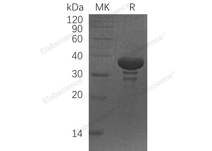 Recombinant Human SGTA Protein (His Tag) - ABMIUM