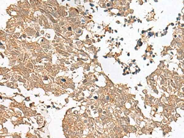 Anti-Human/Mouse/Rat GRASP Antibody