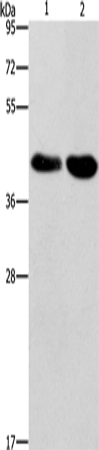 Anti-Human STK17A Antibody - ABMIUM