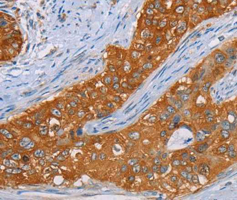 Anti-Human MMP1 Antibody
