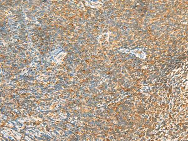 Anti-Human/Mouse/Rat MTHFD2L Antibody