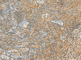Immunohistochemistry of paraffin-embedded Human tonsil tissue using MTHFD2L Polyclonal Antibody at dilution of 1:30(×200)